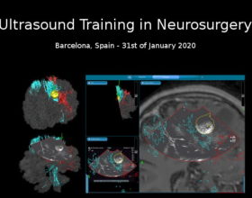 Curso de ecografía neuroquirúrgica impartido por el Dr. de Quintana