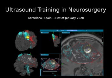 Curso de ecografía neuroquirúrgica impartido por el Dr. de Quintana