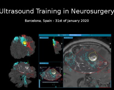 Curso de ecografía neuroquirúrgica impartido por el Dr. de Quintana