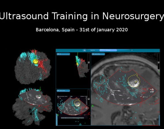 Curso de ecografía neuroquirúrgica impartido por el Dr. de Quintana