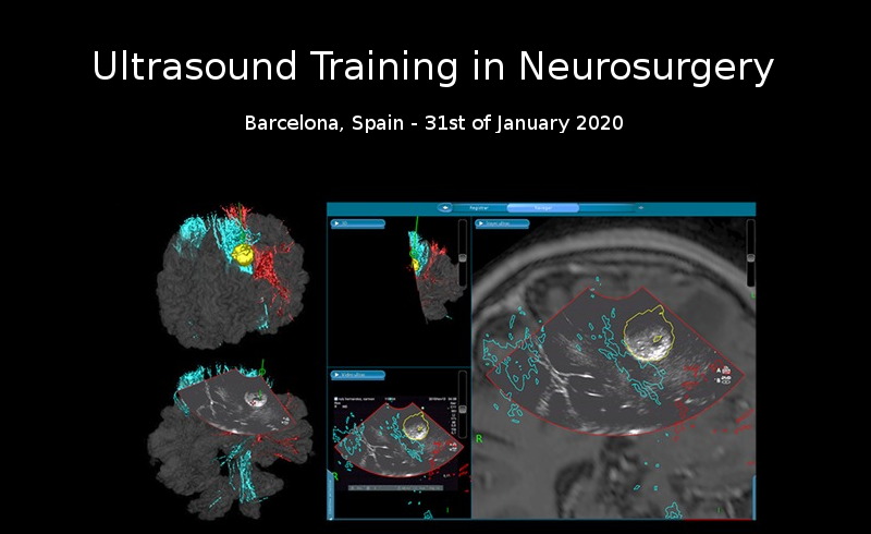 Ultrasound Training in Neurosurgery